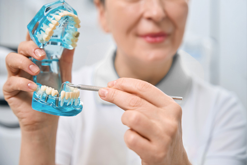 Dr. Helder Torres - Implantes Dentales en Nicaragua